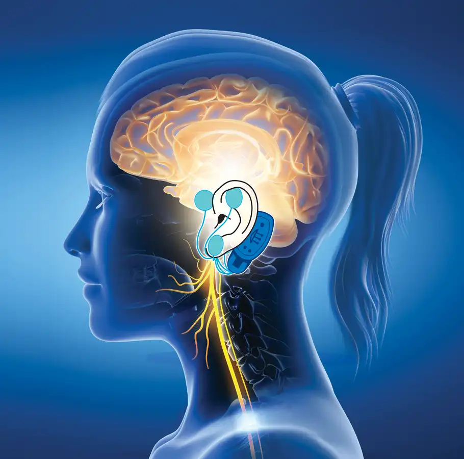 Body diagram illustrating the vagus nerve, highlighting its connection to the brain and digestive system.